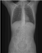 June 2024, tumor image